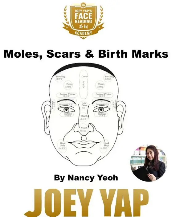 6_Moles Scars and birth marks